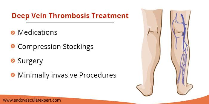 DVT Treatment In Jaipur By Dr Nikhil Bansal Deep Vein Thrombosis