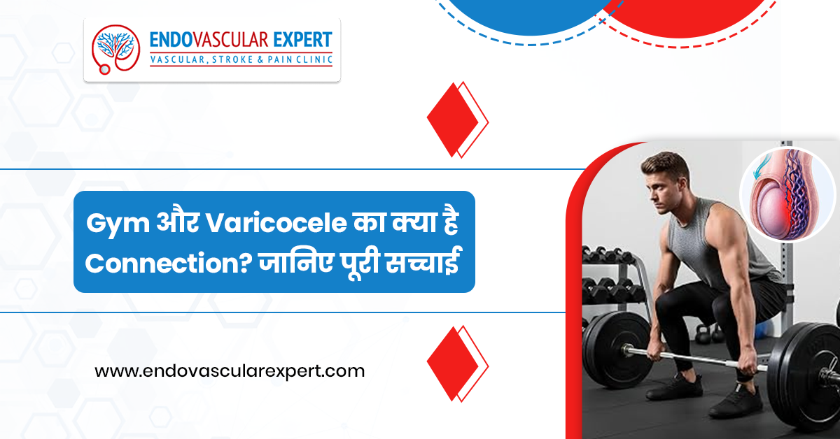 Gym और Varicocele का क्या है Connection? जानिए पूरी सच्चाई 2 Gym और Varicocele का क्या है Connection