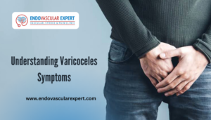 Varicoceles Symptoms