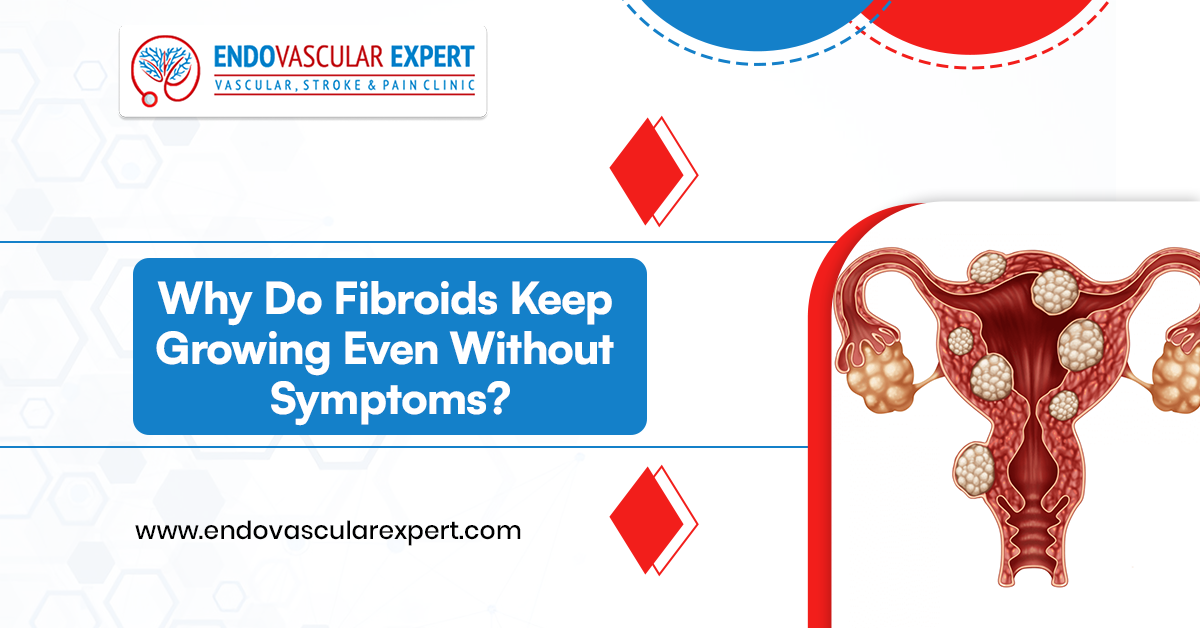 Why Do Fibroids Keep Growing Even Without Symptoms? 2 Why Do Fibroids Keep Growing