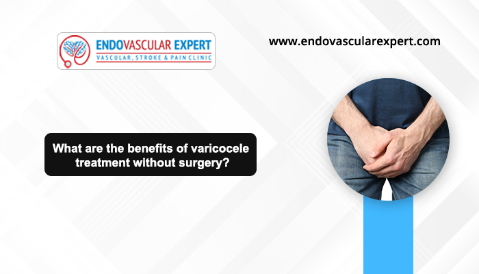 Benefits of Varicocele Treatment Without Surgery