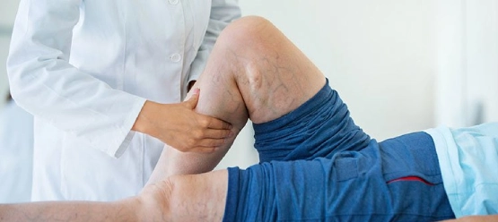 Peripheral Artery Disease Treatment 13 Peripheral Artery Disease